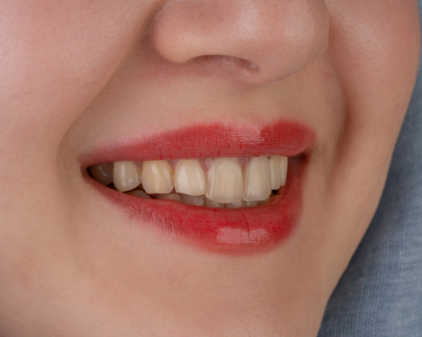 Close-up of a mouth with a missing tooth