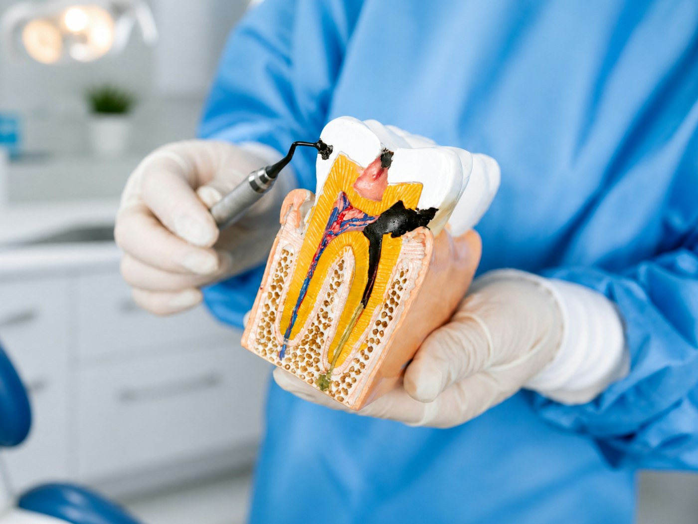 A dentist explaining treatment with a model of a damaged tooth