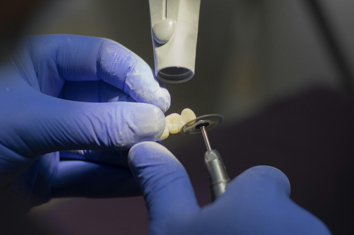 A dentist working on a temporary dental crown
