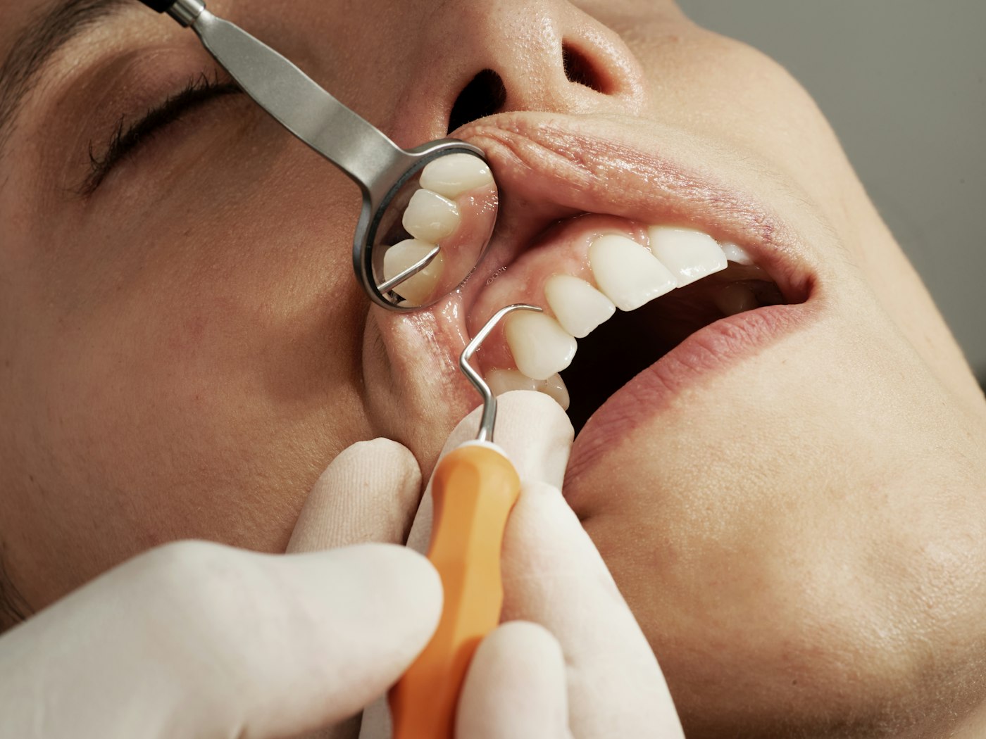A dental examination with a mirror and scaling instrument