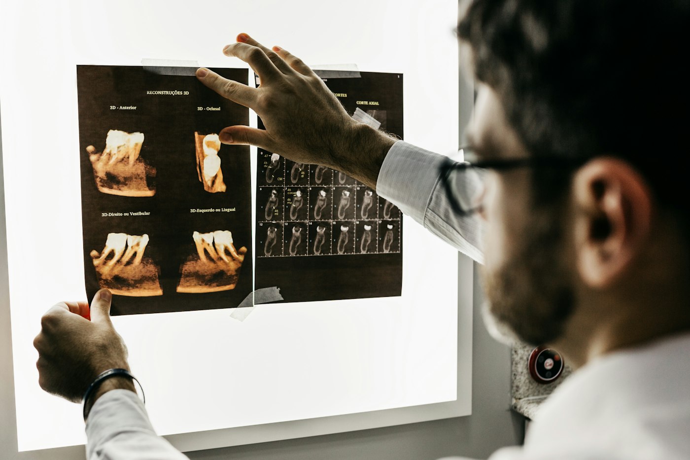 Dentist studying a dental X-ray before root canal treatment