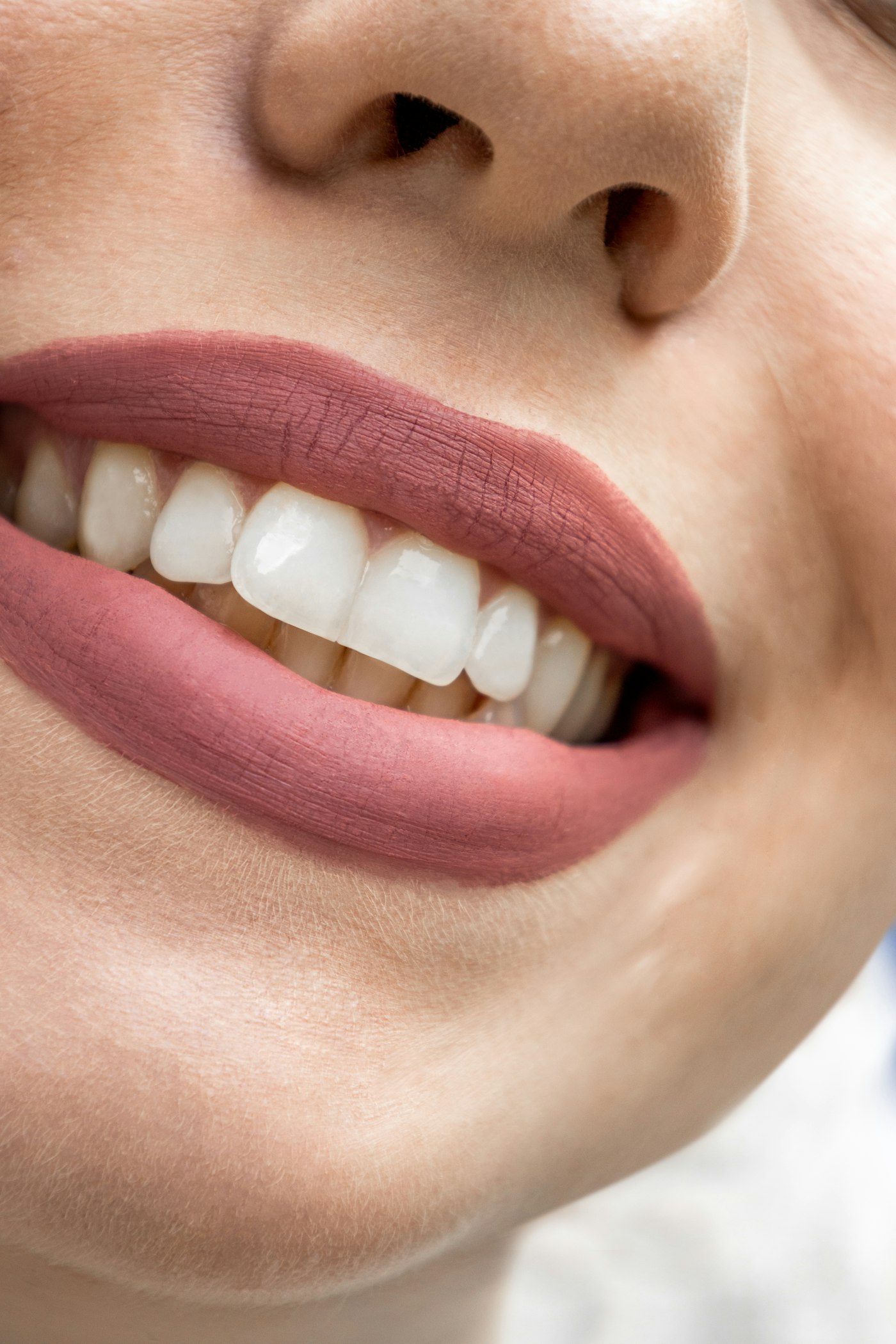 Close-up of a woman's smile with white teeth