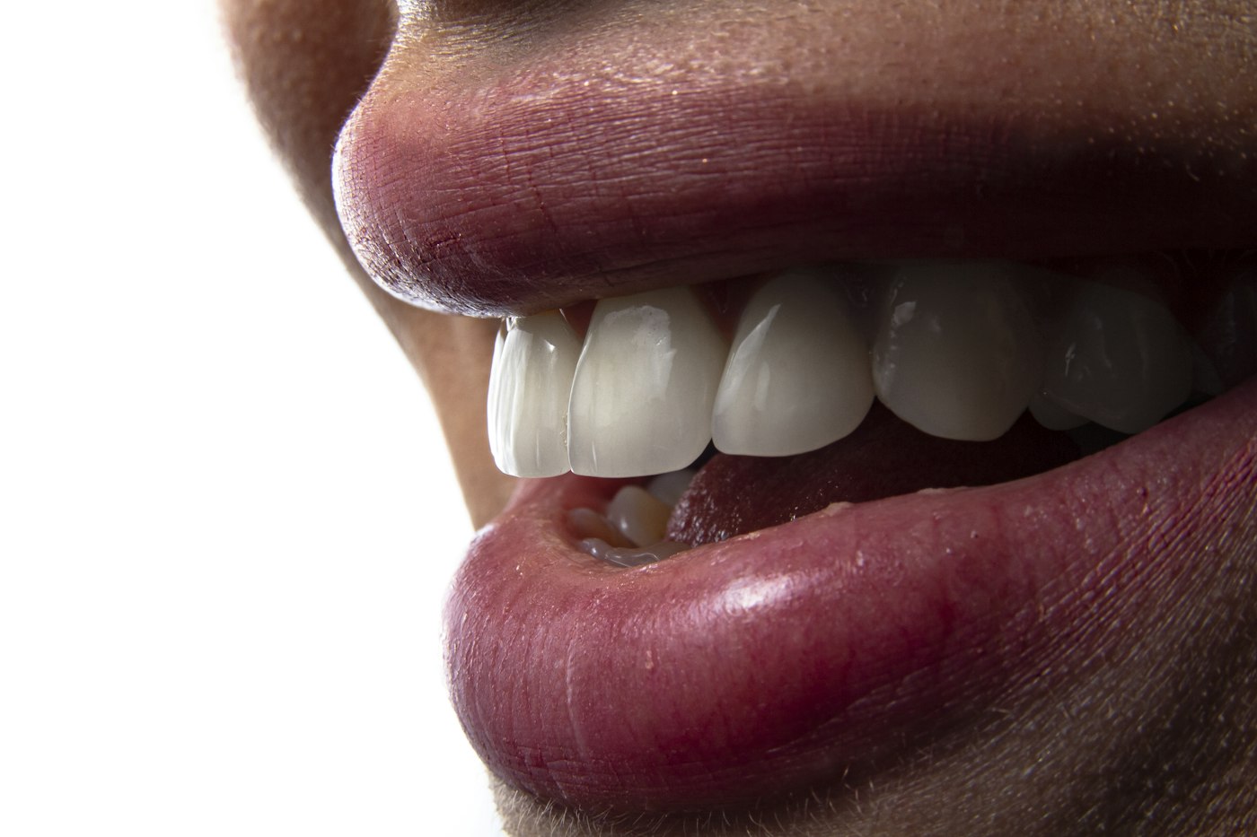 Close-up of a person showing their teeth